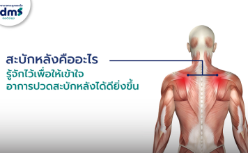 “สะบักจม ปวดร้าวลงแขน”อย่ามองข้าม! รีบจบฝันร้ายจากภัยเงียบไม่กลับเป็นซ้ำๆ