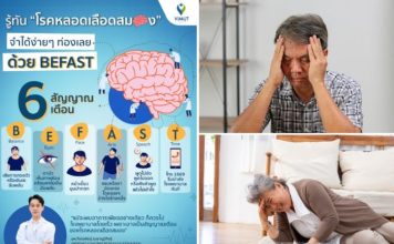 ผู้ใหญ่ 1 ใน 4 มีโอกาสเผชิญ“สโตรก” ใครรู้ไว-รักษาทัน-ลดความเสี่ยงพิการ